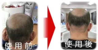 使用前後の写真